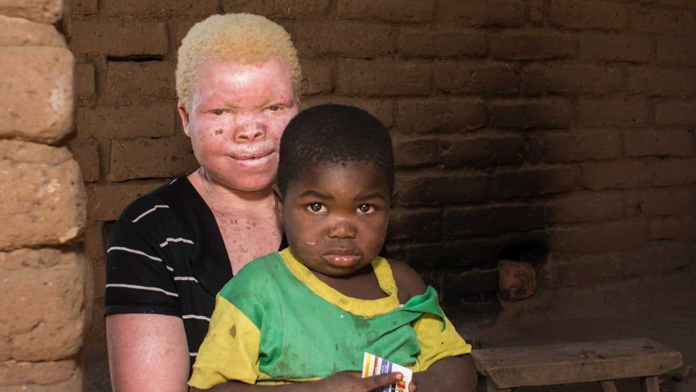 Martha Chipeso und ihr Sohn im Phalombe Distrikt im April 2016. Die 20-jährige Martha wurde im Januar 2016 von einer Gang überfallen, die Nachts in ihr Haus einbrachen. Dank ihrer lauten Schreie konnten ihr Nachbarn zu Hilfe eilen. Einige Verdächtige wurden von der Polizei verhaftet, es kam aber nie zu einem Verfahren. Seither lebt Martha in Angst. © LAWILINK/Amnesty International