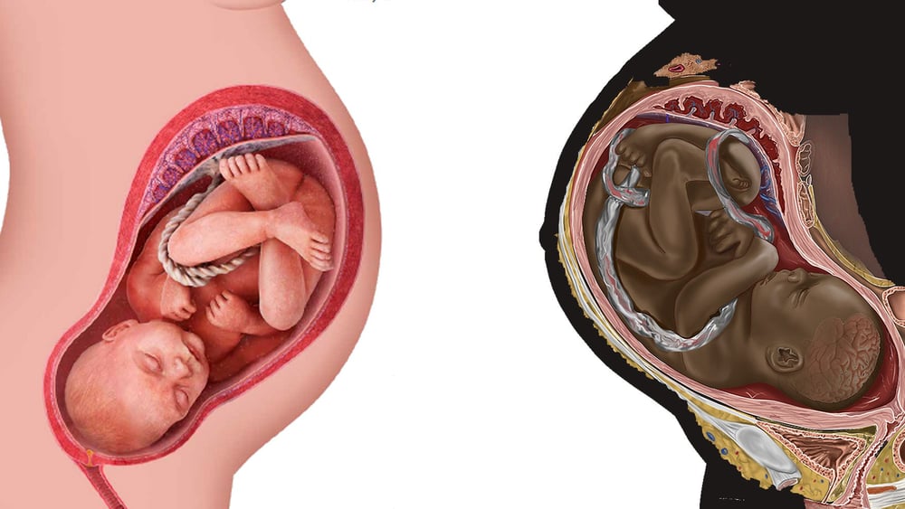Die Mehrheit der medizinischen Darstellungen zeigt weisse Menschen: Chidiebere Ibe wollte das ändern und veröffentlichte eine Zeichnung eines Schwarzen Fötus. © Science Photo Library SPL / DK Images / Keystone © Chidiebere Ibe