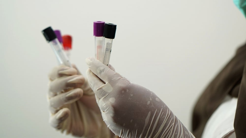 Les gouvernements doivent prioriser leur campagne de vaccination en faveur du personnel de santé © shameersrk - Pixabay