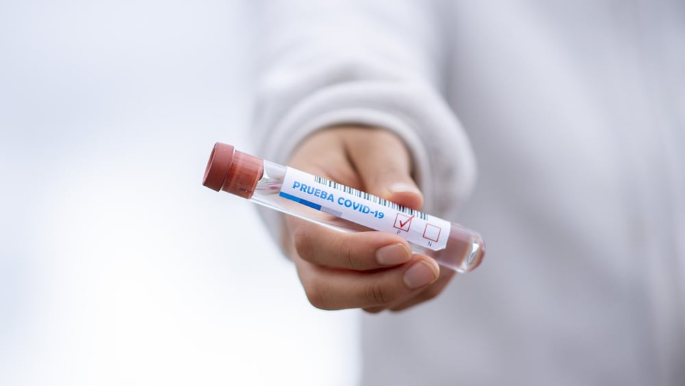 Les gouvernements latino-américains doivent garantir une campagne de vaccination transparente © fernandozhiminaicela - Pixabay