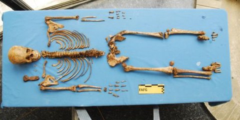 In der guatemaltekischen Stiftung für forensische Anthropologie werden Opfer identifiziert © Private 