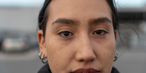 Leidy Cadena wurde am 28. April in Bogotá schwer getroffen und verlor ein Auge, als sie zusammen mit Freunden friedlich demonstierte © Amnesty International