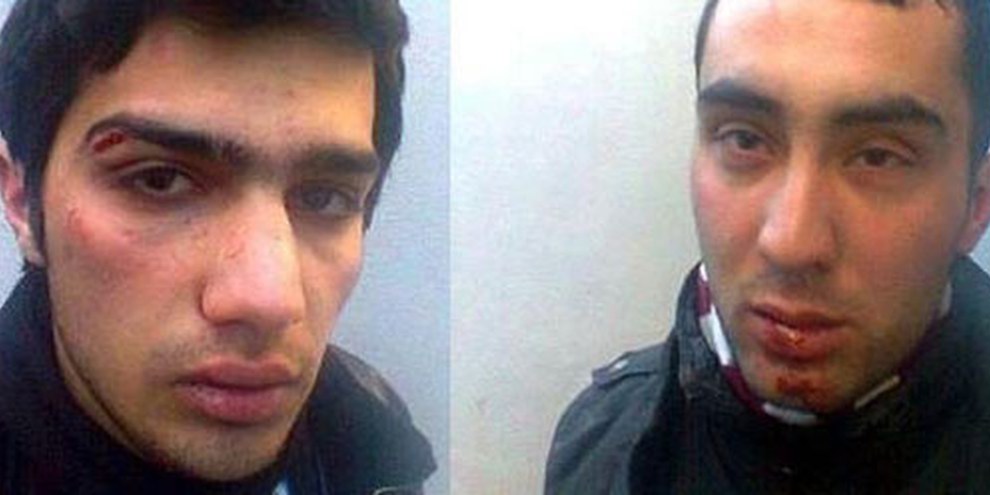 Jabbar Savalan und Dayanat Babayev wurden von Polizisten geschlagen. © Azadliq Newspaper