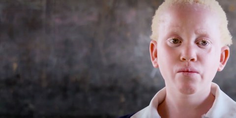 Enfant pourchassée pour des parties de son corps