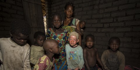 Depuis novembre 2014, au moins 14 personnes atteintes d'albinisme ont été assassinées, leurs membres sont utilisés dans des pratiques rituelles.© LAWILINK/Amnesty International