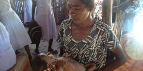 Une femme tient dans ses bras un enfant malnutri dans la zone du Vanni. © DR
