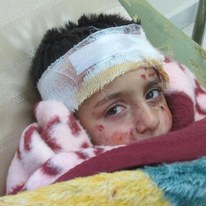 Les enfants sont les premières victimes des bombardements. © AI