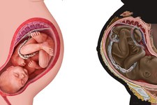 Le serment d'Hippocrate mis à mal