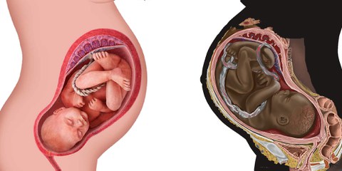 Le serment d'Hippocrate mis à mal