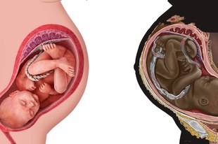 Le serment d'Hippocrate mis à mal